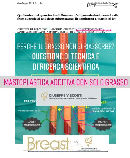 lipofilling roma